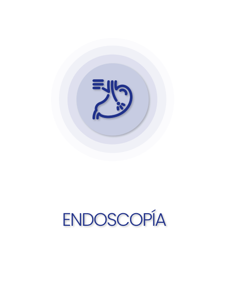 Endoscopía